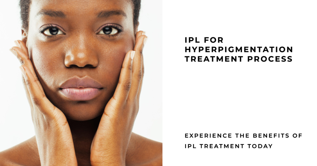 IPL for Hyperpigmentation Treatment Process