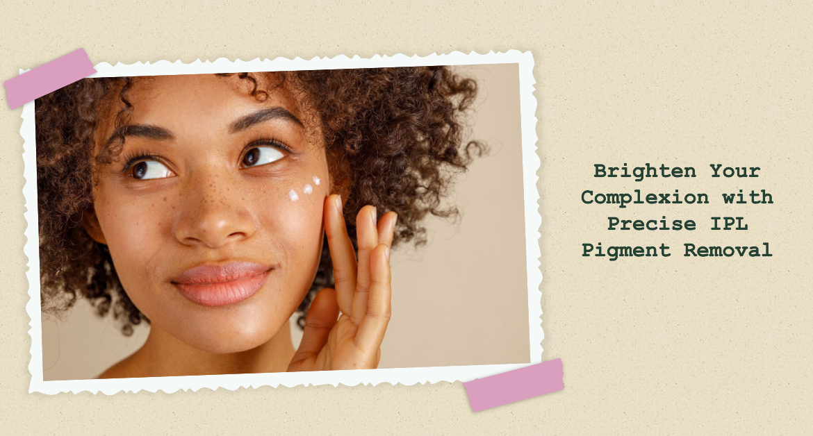 Say Goodbye to Hyperpigmentation with IPL